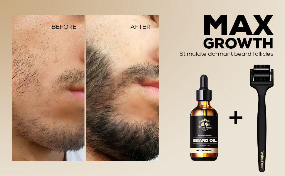 Biotin Beard Growth Kit for Men with Derma Roller 0.25 mm